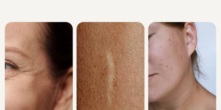  Rekonvalescence zůstává minimální, zatímco efekt je maximální. 