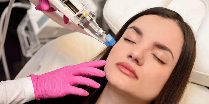 Omladenie pokožky pomocou Vital Injectoru s kyselinou hyalurónovou