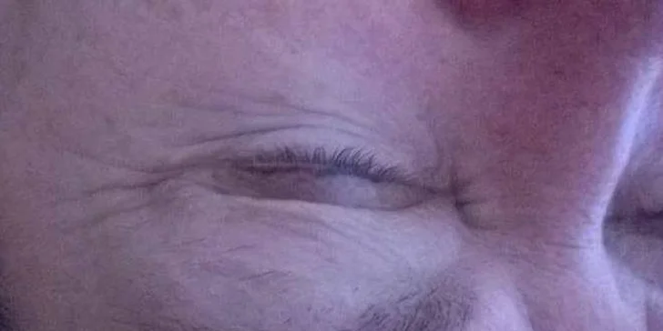 před procedurou
