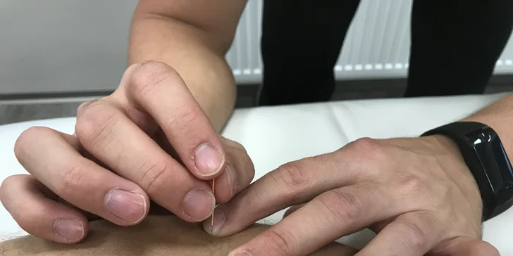 Komplexní fyzioterapeutické vyšetření a terapie v délce 80 minut