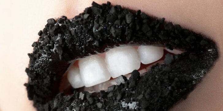 Zářivý úsměv šetrně: Neperoxidové bělení zubů s remineralizací skloviny
