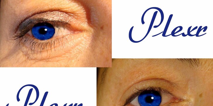 Eliminace nadbytečné kůže na horních či dolních očních víčkách