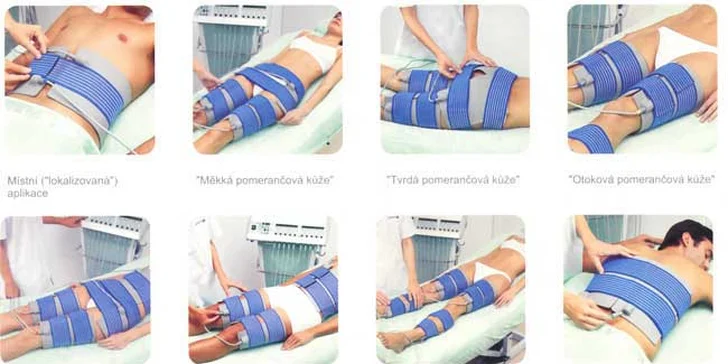 Pryč s tuky: 1 až 10 ošetření přístrojem Bodyter, který pomáhá k zeštíhlení, zpevnění a tvarování těla