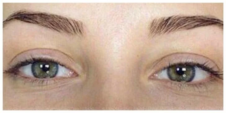 Prodlužování řas metodou řasa na řasu značkou Smart Lashes