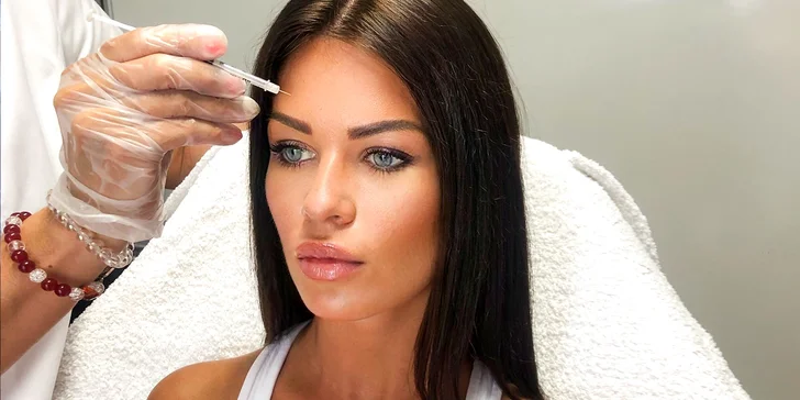 Aplikácia botulotoxínu proti vráskam alebo poteniu v salóne Dermafresh