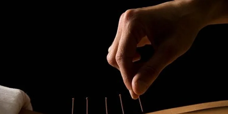 1500 Kč za odvykání kouření pomocí akupunktury v hodnotě 2500 Kč v Praze