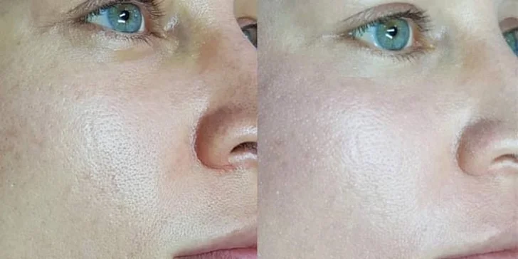 Revoluční novinka pro vždy krásnou pleť: BB glow treatment