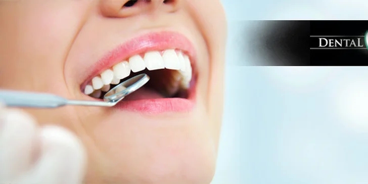 Top ambulantná dentálna hygiena alebo bielenie zubov