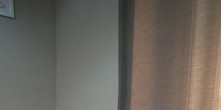 Laser odstraní chloupky v oblasti horního rtu, bikin i podpaží.