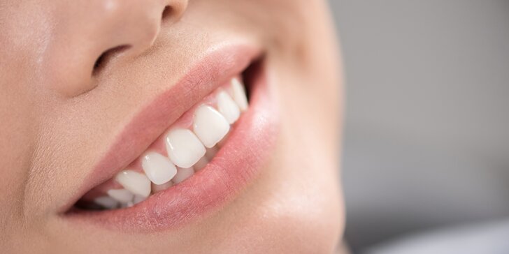 Zářivý úsměv šetrně: Neperoxidové bělení zubů