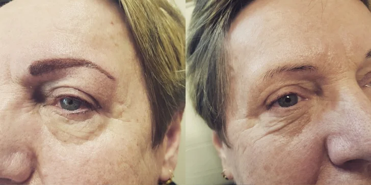 Krásné obočí: kombinace dvou technik microblading + vlásková metoda