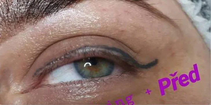 Pro smyslný pohled i bez umělých řas: lash lifting a lash botox