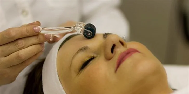 499 za 3D Facelift  RF včetně aplikace kys. hyaluronové přímo do vrásek