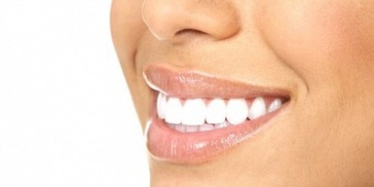 2590 Kč za bělení zubů systémem Opalescence v původní hodnotě 3490 Kč