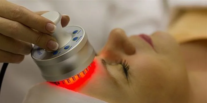 499 za 3D Facelift  RF včetně aplikace kys. hyaluronové přímo do vrásek