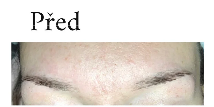 Zvýraznění obočí: microblading neboli permanentní make-up vláskováním