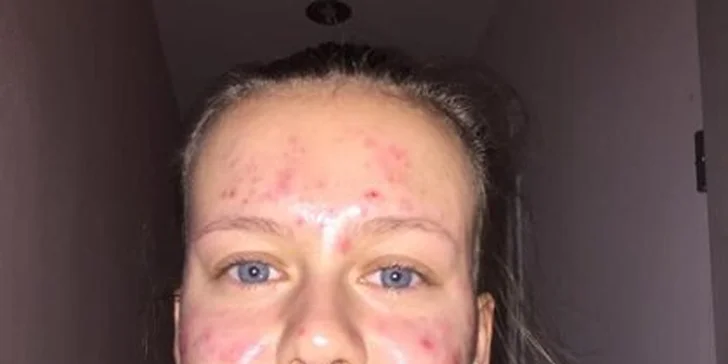 Na výběr máte balíčky navíc s kolagenovou či alginátovou maskou.