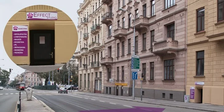 Štíhlá bezbolestně a bez diet díky kryolipolýze: 1, 3, 5 či rovnou 10 ošetření