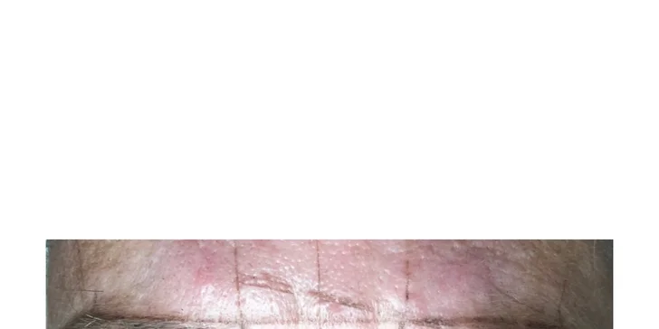 Zvýraznění obočí: microblading neboli permanentní make-up vláskováním
