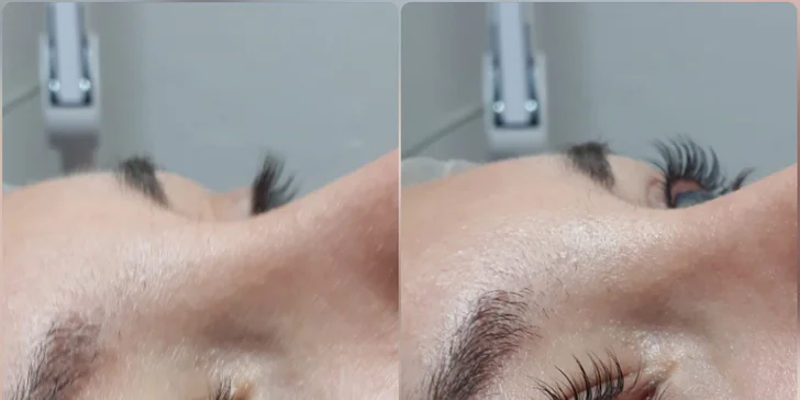 Pro smyslný pohled i bez umělých řas: lash lifting a lash botox