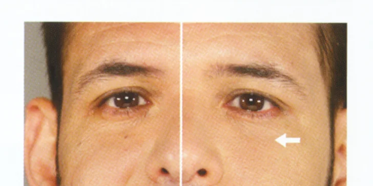 Omlazení pleti revoluční galvanickou metodou Nu Skin Galvanic Spa