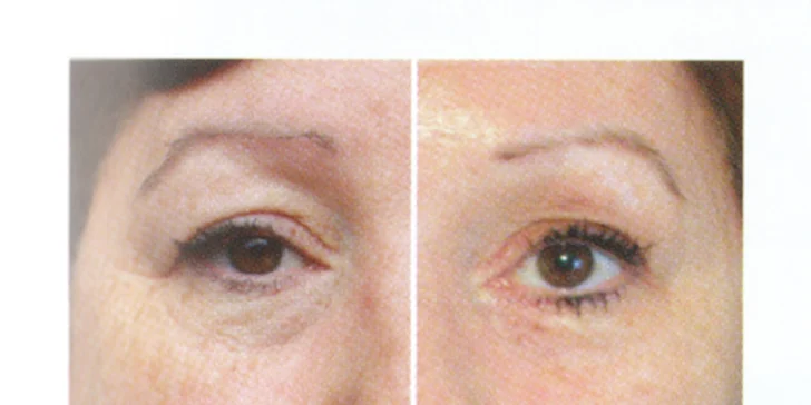 Omlazení pleti revoluční galvanickou metodou Nu Skin Galvanic Spa