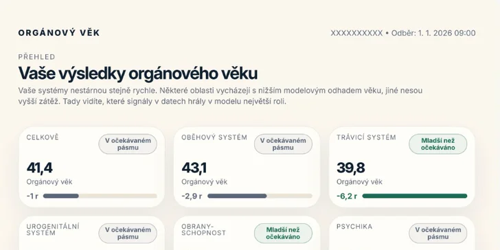 Celý proces je navržen tak, aby byl pro vás maximálně pohodlný a efektivní.
