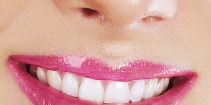 Bělení zubů unikátní metodou - zářivý úsměv na plesovou sezónu