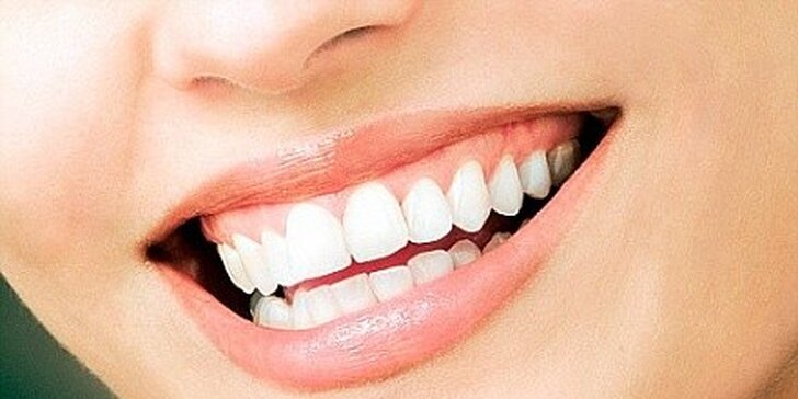 Mějte úsměv zářivý jako hvězda - bělení zubů v Lounech