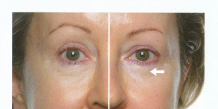 Omlazení pleti revoluční galvanickou metodou Nu Skin Galvanic Spa