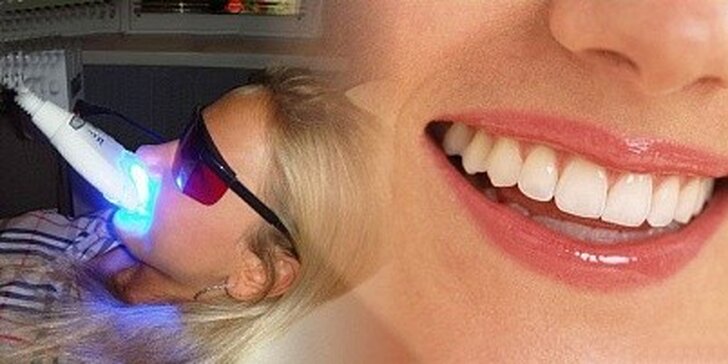 Neperoxidové bělení zubů metodou zvanou Smile Brilliant Teeth Whitening