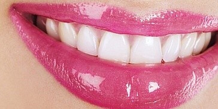 Bělení zubů unikátní metodou - zářivý úsměv na plesovou sezónu