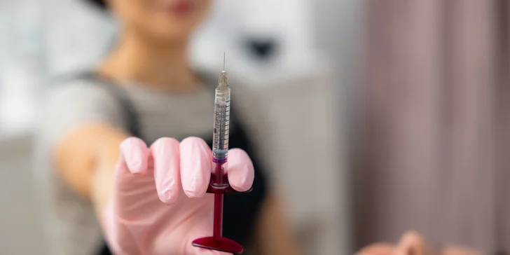Kyseliny hyalurónovej vám bude injekčne aplikovaná priamo do pokožky
