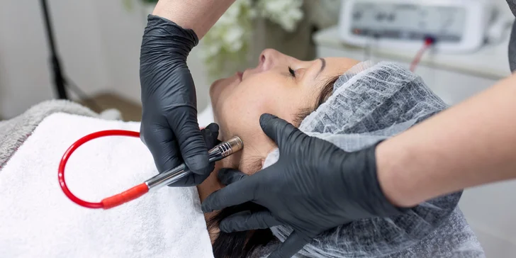 Všetko pre krásnu pleť: Dermabrázia či rádiofrekvencia s čistením pleti