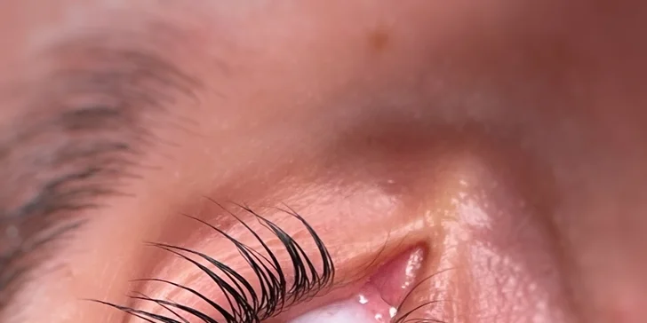 Ukážka práce: Babydoll Lashlift & botox
