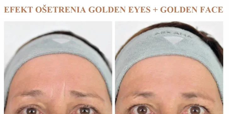 Efekt ošetrenia golden eyes + golden face