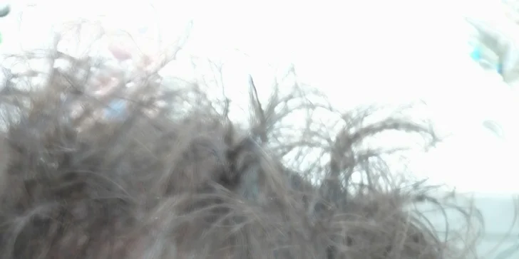 Podpora růstu vlasů - před ošetřením 