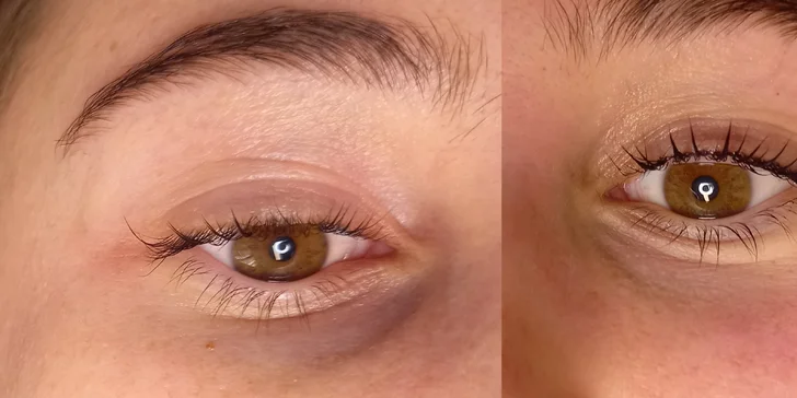 Lash lifting