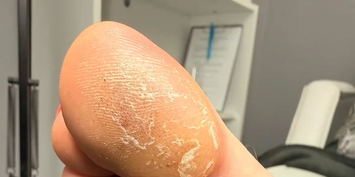 Starostlivosť od zakladateľky salónu Lany s viac než 16 akreditáciami a lektorským certifikátom. (Pred)