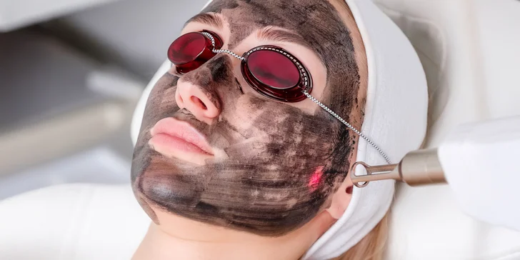 Peeling pro omlazení pleti: maska s aktivním uhlím a laserové ošetření