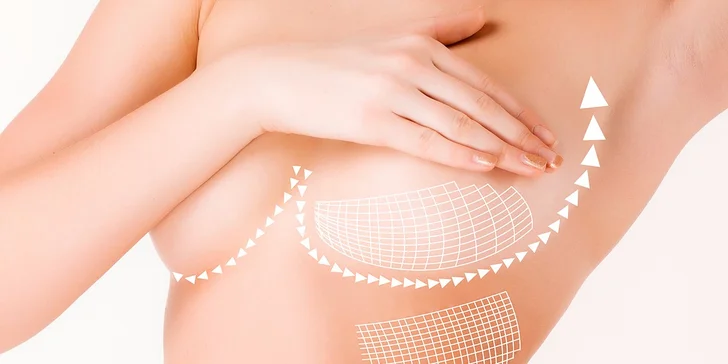 Okouzlete sexy dekoltem: Plastická operace prsou na Prague Aestetic Clinic