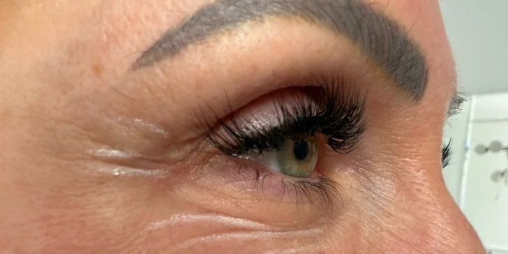 Plazmalifting fibroblast