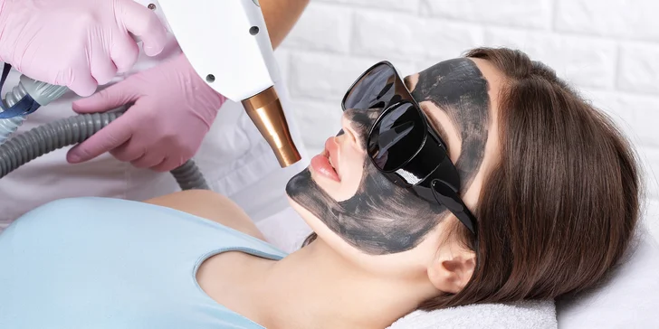 Holywood Peel: Karbónový peeling tváre, krku či dekoltu na redukciu pigmentových škvŕn, akné alebo vrások