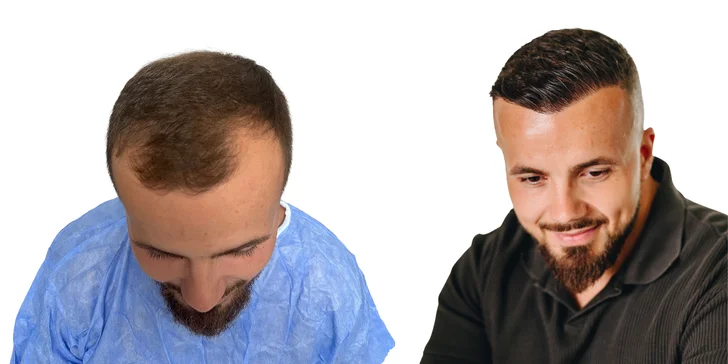 Pred a po - viac ako 16 mesiacov