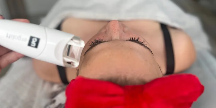 Procedura vyhlazuje vrásky, zpevňuje pleť a stimuluje tvorbu kolagenu.