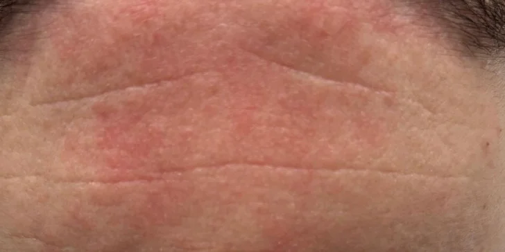 Hladšia a jemnejšia pokožka bez botoxu? V NOIA Beauty v Nitre vedia ako na to!