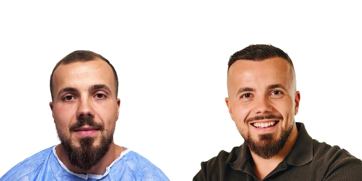 Pred a po - viac ako 16 mesiacov
