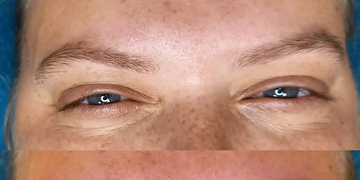 Lash lifting řasy elegantně natočí a pozvedne tak, že budou působit delší a výraznější.