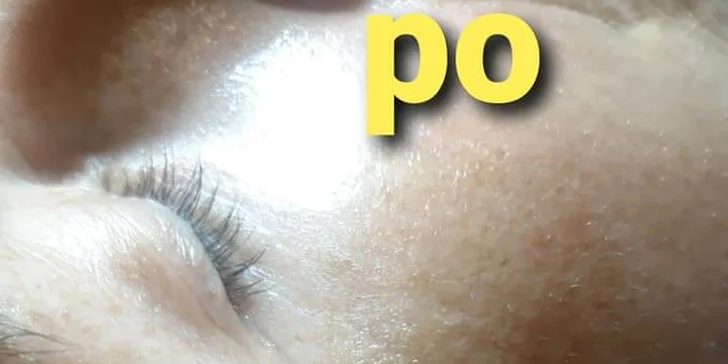 Vaši pokožka bude znovu svěží, hydratovaná, vyživená a rozjasněná.