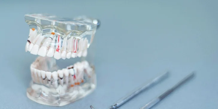 Cílem ošetření je získání dovedností v péči o chrup – tj. používání vhodného kartáčku, mezizubních kartáčků a vhodné techniky čištění.
